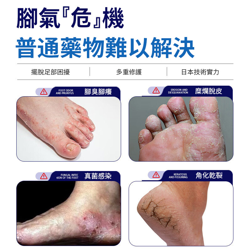 【食藥署認證 日本爽腳噴劑】✨ 台大皮膚部主治醫師烏惟新推薦🦶，針對角化型香港腳設計，噴劑殺菌止癢💥，改善腳癬、脫皮、裂縫、腳臭、水泡與異味｜二重ケア🇯🇵 深層滲透厚角質，修護乾裂脫屑👌